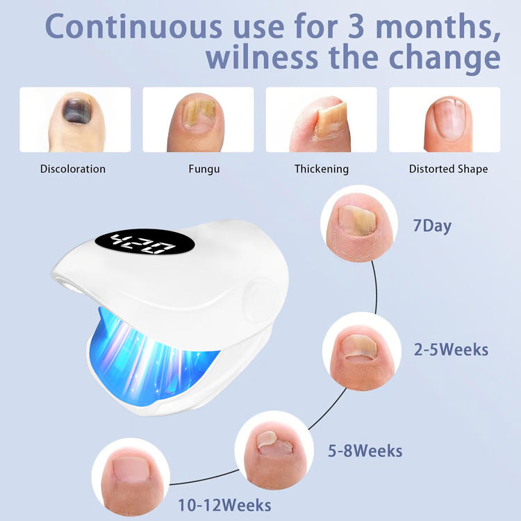 Laser Nail Fungus Treatment Lamp Portable nail fungus treatment Device for Clear Healthy Nails