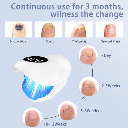 Laser Nail Fungus Treatment Lamp Portable nail fungus treatment Device for Clear Healthy Nails